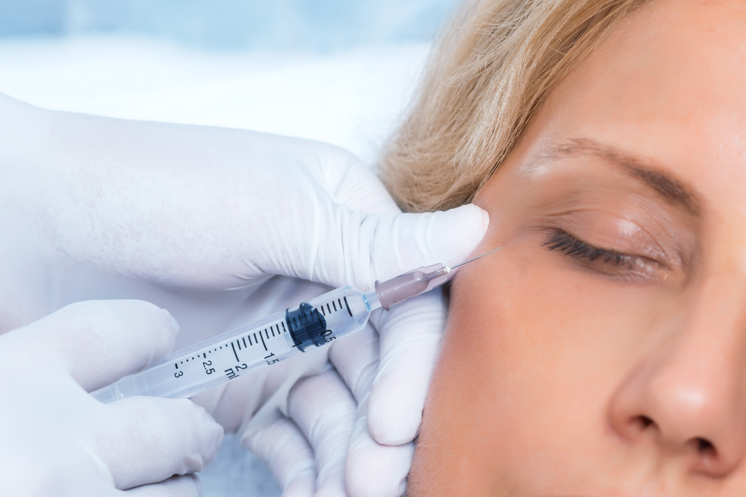 dermatologija/Glajenje-gub-Ljubljana.png