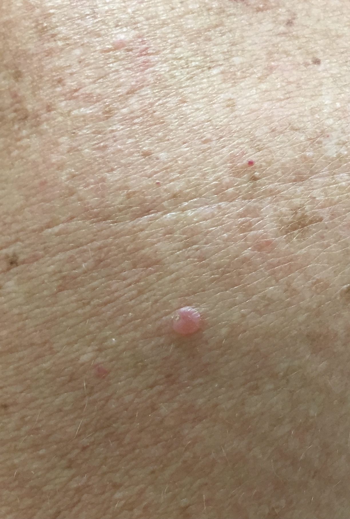 dermatologija/IMG_6726.jpg